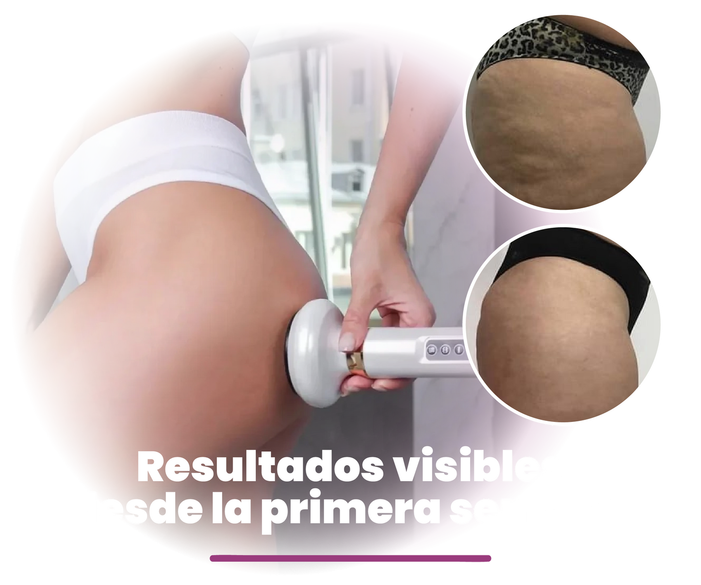 MASAJEADOR ANTI CELULITIS