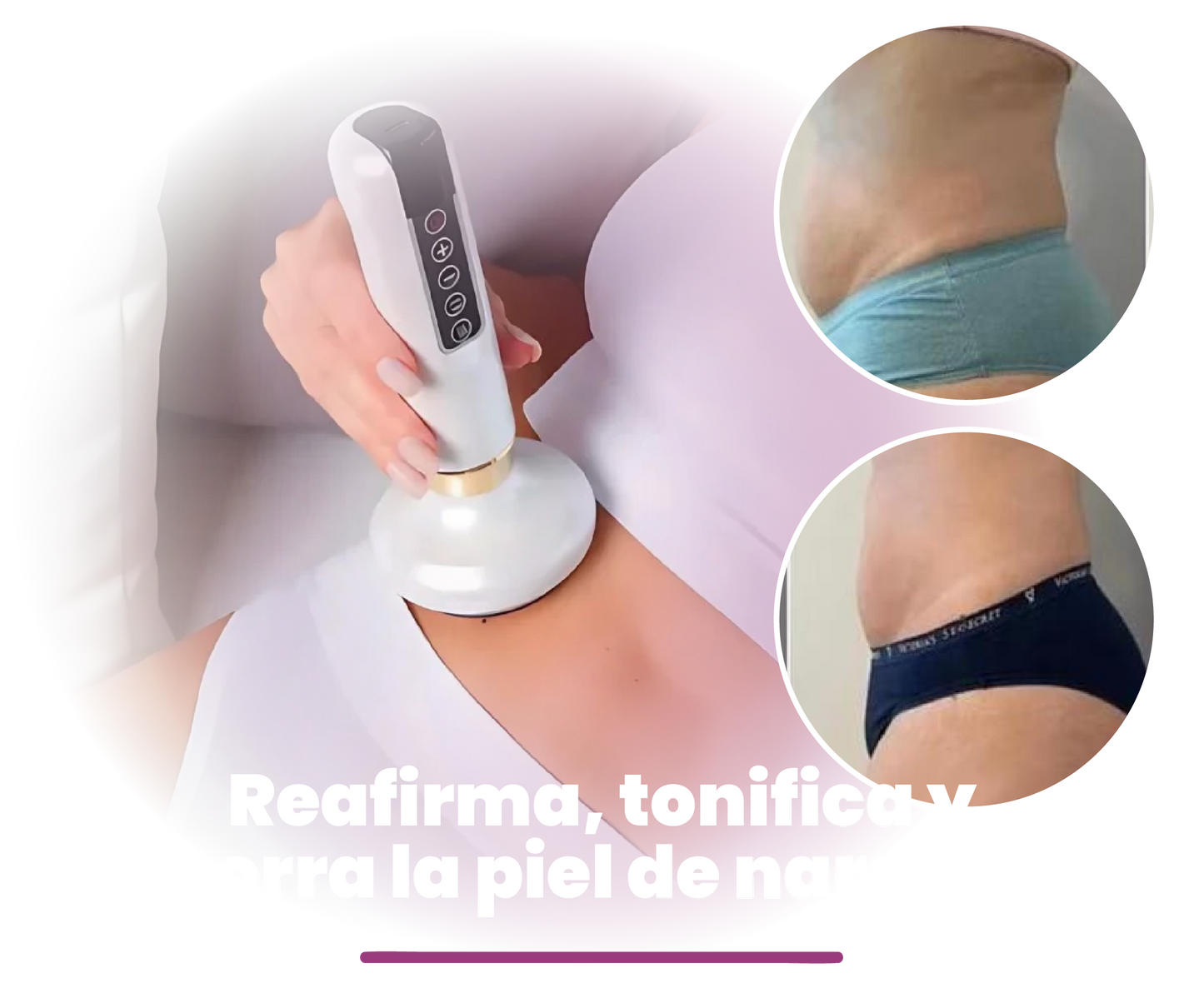 MASAJEADOR ANTI CELULITIS