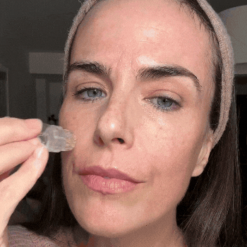 GLAMORY™ TRATAMIENTO FACIAL CON MICRONEEDLING
