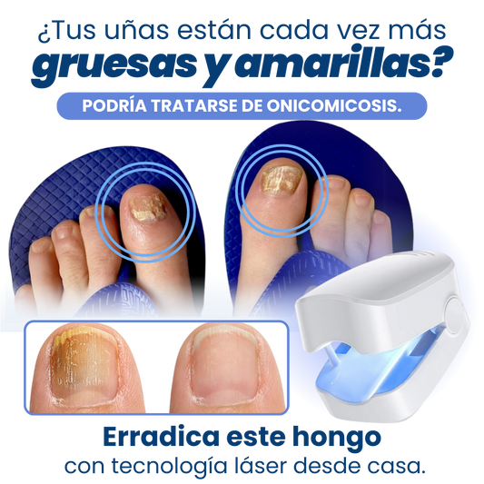 LAMPARA LASER PARA UÑAS