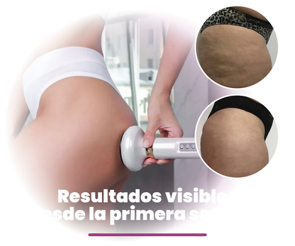 MASAJEADOR ANTI CELULITIS