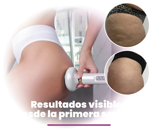 MASAJEADOR ANTI CELULITIS