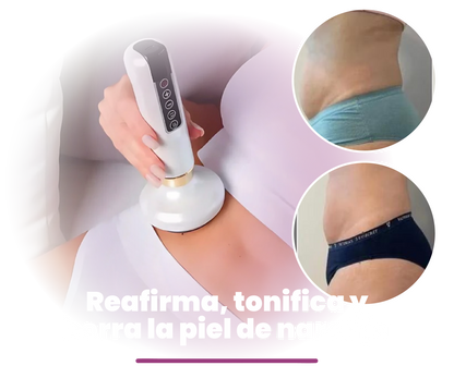 MASAJEADOR ANTI CELULITIS