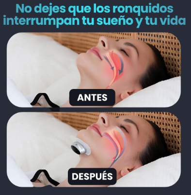 Dispositivo Antironquidos